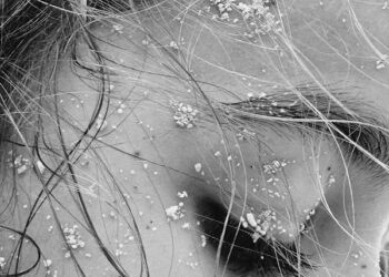 Özledim / Nur   Bozkurt