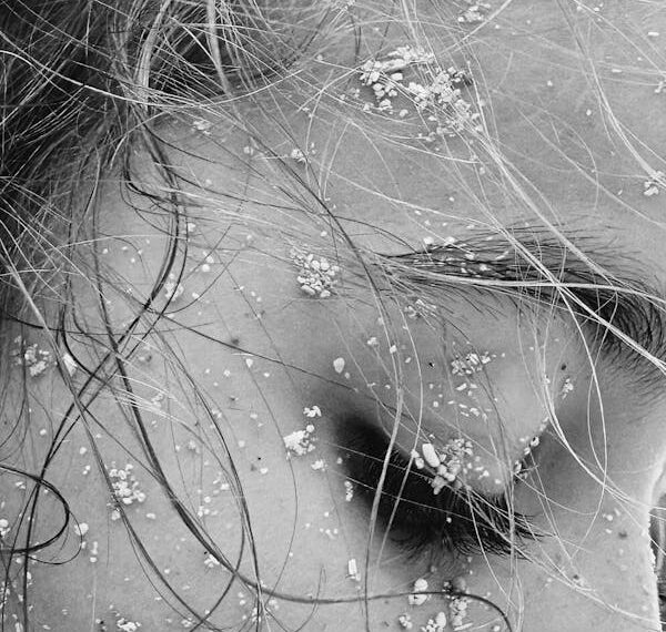 Özledim / Nur   Bozkurt