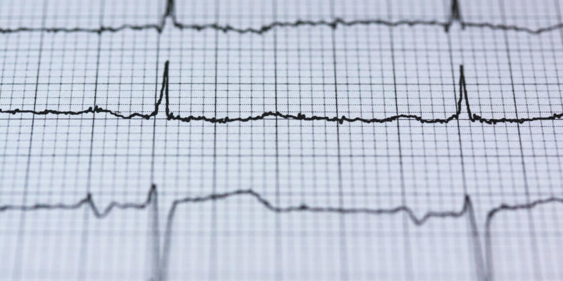 Kalp Atışı / Tuba Dilek