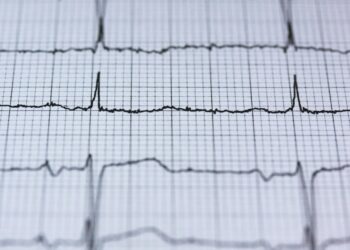 Kalp Atışı / Tuba Dilek